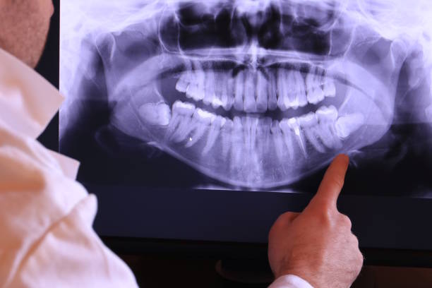 Best Tooth Infection Emergency Dentist  in Leisure Village West, NJ