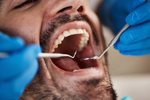 Best Broken Tooth Emergency  in Leisure Village West, NJ